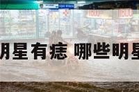 哪些明星有痣 哪些明星痣多