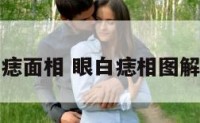 眼白痣面相 眼白痣相图解大全