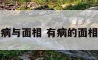 病与面相 有病的面相