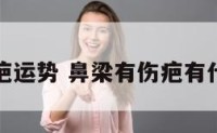 鼻梁伤疤运势 鼻梁有伤疤有什么寓意