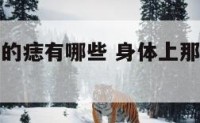 身体上罕见的痣有哪些 身体上那些痣的吉凶位置好图