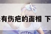 下巴后天有伤疤的面相 下巴有伤痕