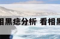 面相黑痣分析 看相黑痣