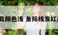 鱼际线短且颜色浅 鱼际线发红是何原因?
