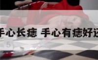 看手相手心长痣 手心有痣好还是不好