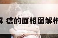 痣的面相图解 痣的面相图解析,厄警失解析