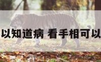 看手相可以知道病 看手相可以看出病吗