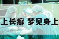 梦到自己身体上长癣 梦见身上长癣怎么回事