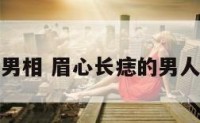 眉心长痣的男相 眉心长痣的男人有什么意义