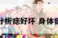 身体上分析痣好坏 身体痣的含义