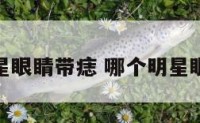 哪个明星眼睛带痣 哪个明星眼下有痣
