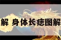 身体上长痣图解 身体长痣图解大全代表什么