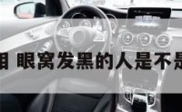 眼窝黑面相 眼窝发黑的人是不是不好相处