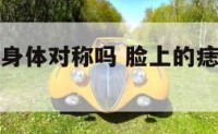 脸上有痣跟身体对称吗 脸上的痣与身体上的痣对应吗
