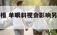 单眼斜视面相 单眼斜视会影响另一个眼睛吗?